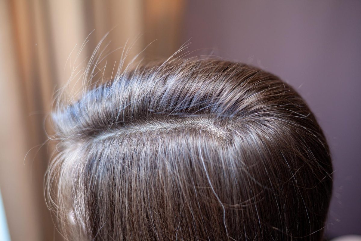Quick fixes for the in-between stage
